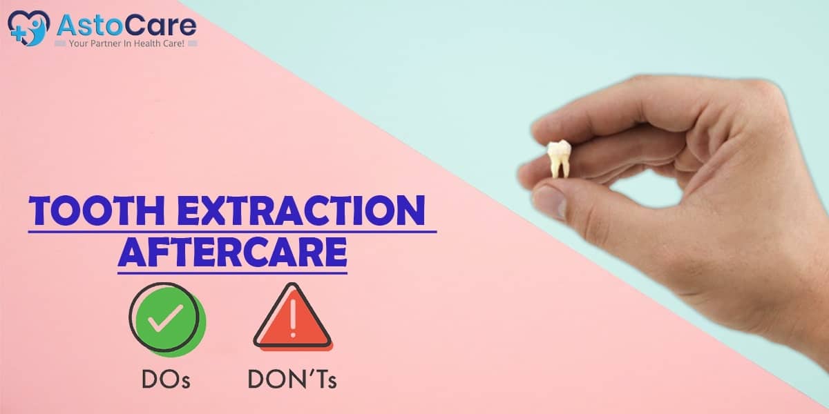 Tooth Extraction Aftercare: Do’s and Don’ts